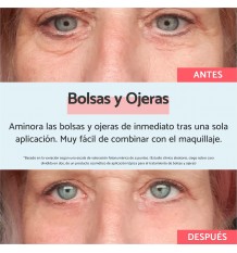 Remescar Bolsas Ojeras Reductor Vegetal 8 ml