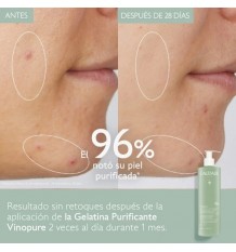 Caudalie Vinopure Gelatina Limpiadora Purificante 385ml