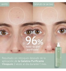 Caudalie Vinopure Gelatina Limpiadora Purificante 385ml