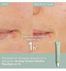 Caudalie Vinopure Stop Granos Salicílico 15 ml