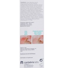 Neostrata Restore Serum Antiedad Antirojeces 29 g