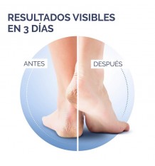 Scholl Crema Talones Agrietados Active Repair K 60ml