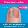 Excilor Forte Tratamiento 30dias + Esmalte Color Nude 8ml