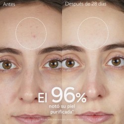 Caudalie Vinopure Gelatina Limpiadora Purificante con Acido Salicílico 75ml