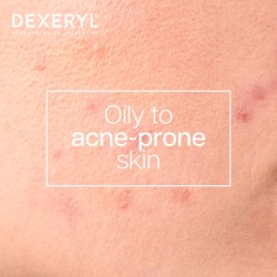 Dexery Dexeclear Gel Limpiador Anti-imperfecciones 400ml