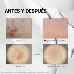 Vt Cosmetics Reedle Shot 100 Booster For Deep Improvement Of Skin Texture 50ml