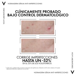 Vichy Normaderm Serum Probio 30ml