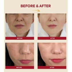 K-Secret Seoul 1988 Esencia Snail Mucin 97% + Rice 100ml