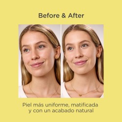 Acniben CC Cream Cobertura Instantánea Spf30 Light 40ml