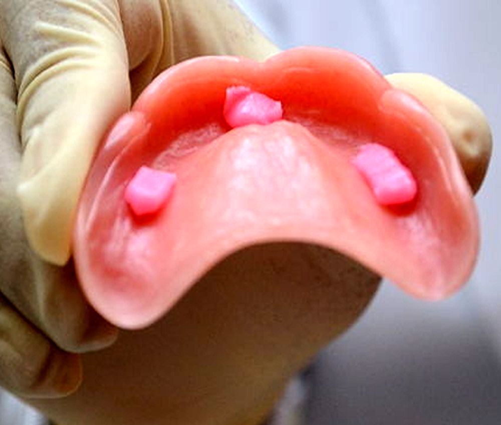 La importancia de la crema fijadora de dentaduras