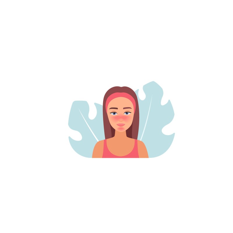 Miniatura de Rosacea Tratamiento